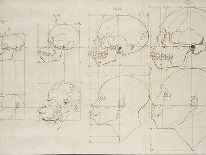 Drawings by Petrus Camper comparing human and monkey craniums.