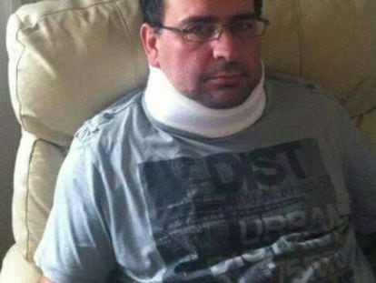 Adolfo Infante after being assaulted in October 2013.