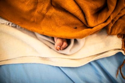 A child's foot peeks out from under a bed sheet at the hospital in Trócaire.