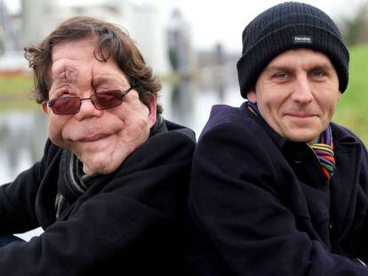 British actor Adam Pearson (left) with his twin brother Neil.