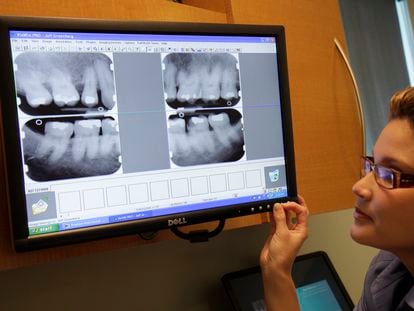 A dental clinic assistant looks at an x-ray that shows periodontitis.