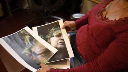Alba holds up photos of her battered face after an attack.