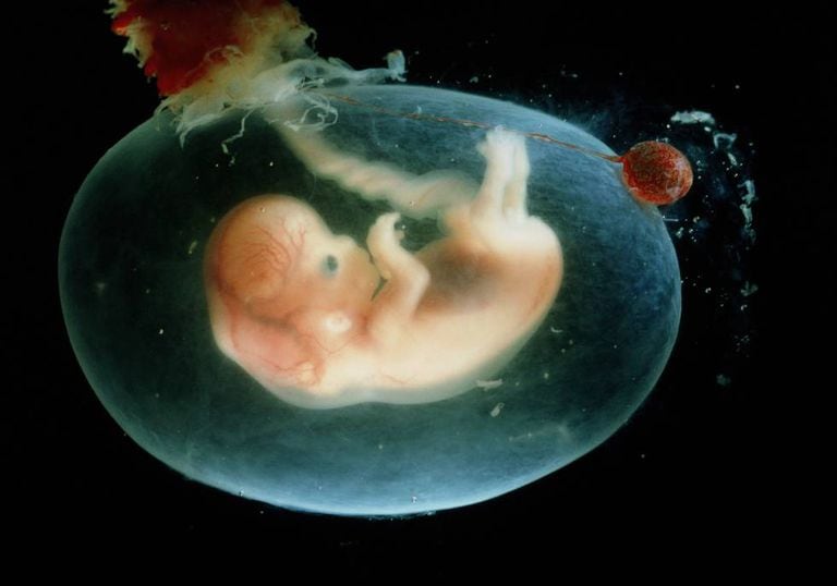 A human embryo at seven to eight weeks.