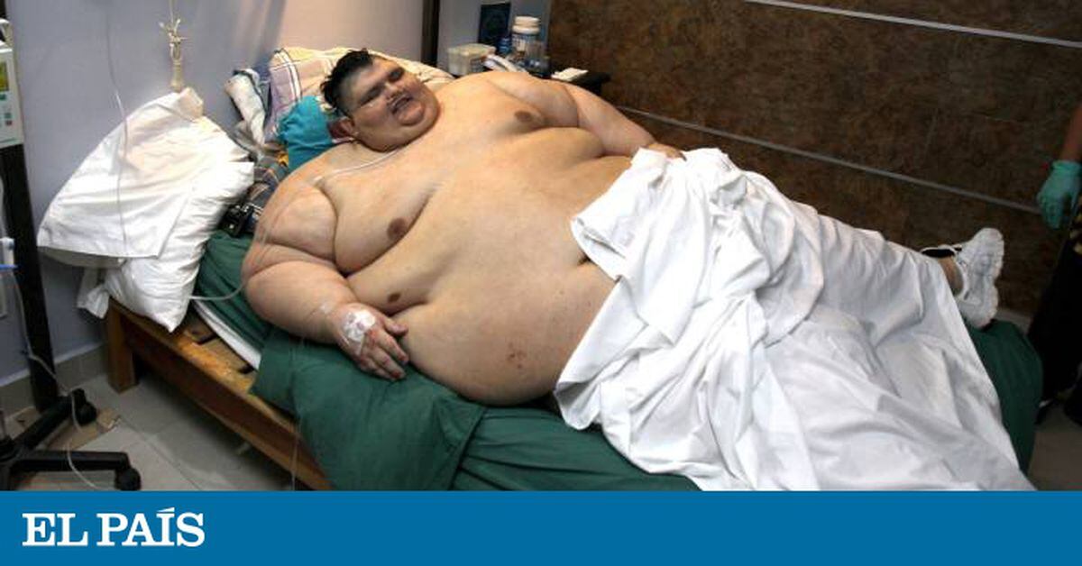 World S Fattest Man In Mexico World S Heaviest Man Operated On To Reduce His Stomach International El Pais English Edition