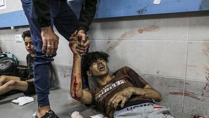 Wounded Palestinians in a corridor of Al Shifa hospital on Tuesday.