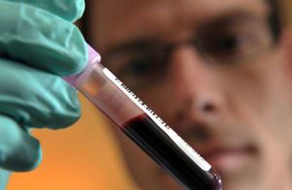 A scientist holds up a blood sample at the Swiss Laboratory for Doping Analyses in Lausanne.
