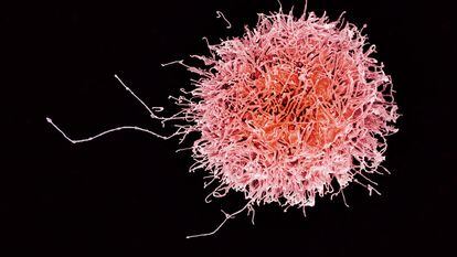 A cancer cell as seen through a microscope.