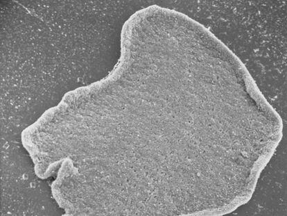 A placozoan under a microscope.
