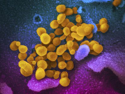 This image made available by the U.S. National Institutes of Health in February 2020 shows the Novel Coronavirus SARS-CoV-2, indicated in yellow.