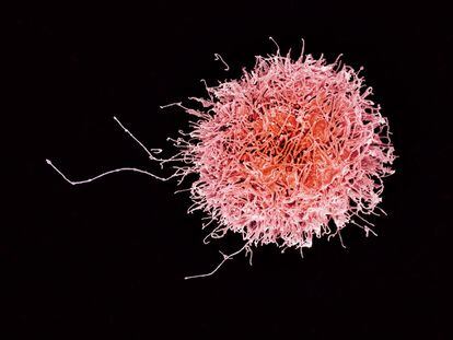 A cancer cell as seen through a microscope.