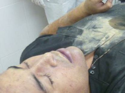 El Lazca&#039;s body lies in a mortuary in this photograph supplied by the Mexican government Tuesday.