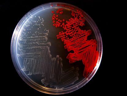 Bacteria cultivated in a lab.