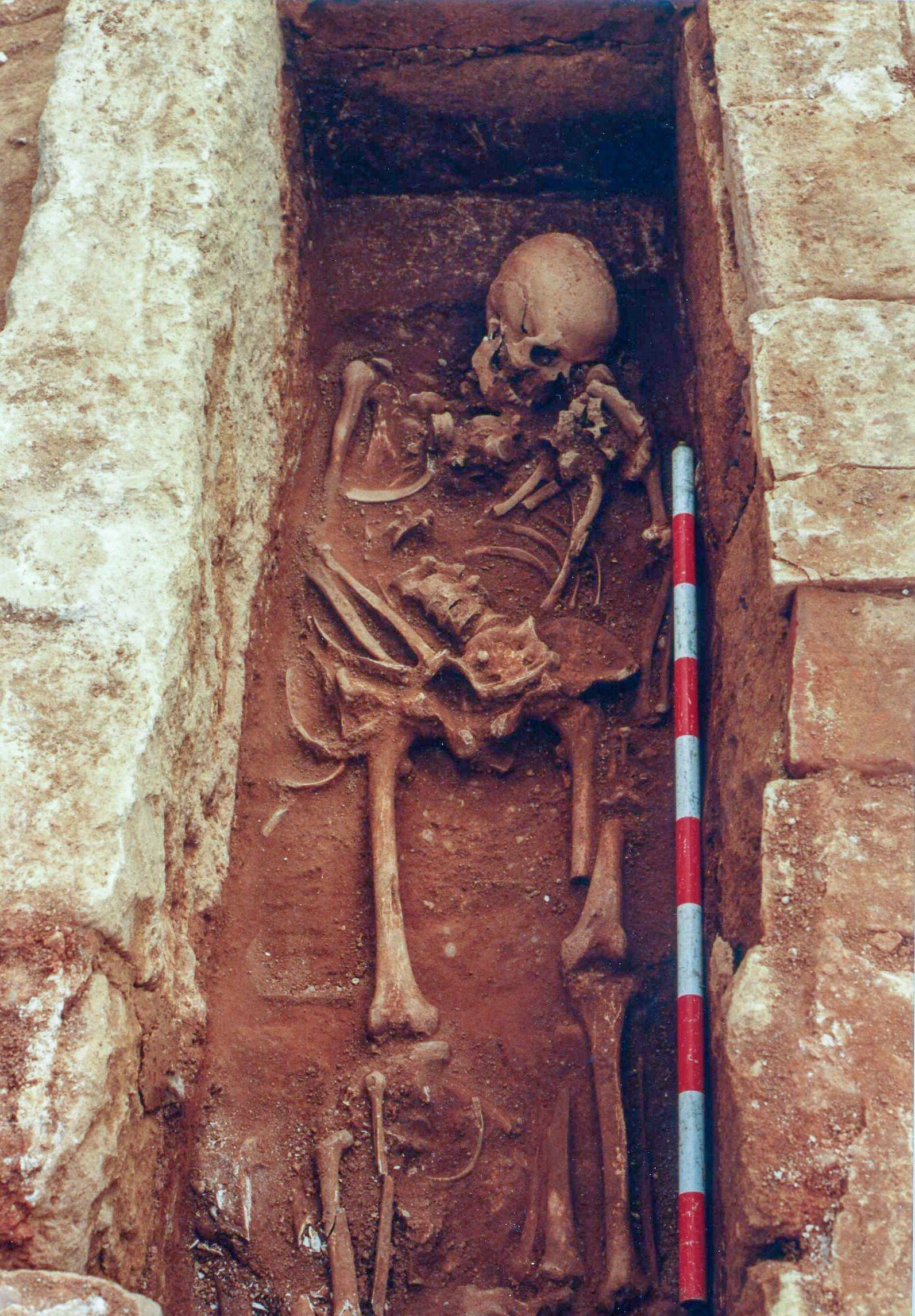 Skeleton of a Christian buried in Cercadilla who lived during the Caliphate years (756-929), bearing an axe wound to the head.