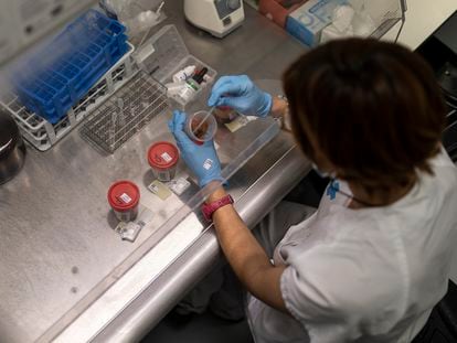 A health worker analyzes fecal samples in search of the ‘Clostridioides difficile’ bacterium, at the Hospital de Bellvitge in Barcelona, Spain.