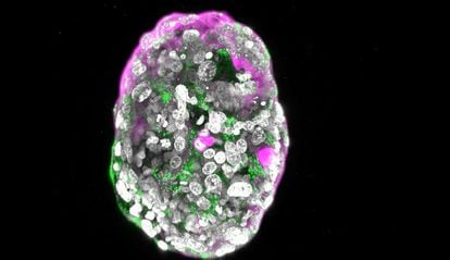 Modelo de embrión humano de 8 días, creado por el laboratorio del científico palestino Jacob Hanna, del Instituto Weizmann de Ciencias