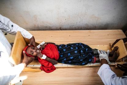 Trabajadores del hospital de Trocaire, en Dolow, Somalia, miden a la pequeña Rahma, de cuatro años, a su llegada al centro. 