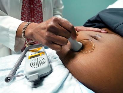 A doctor uses a hand-held Doppler probe on a pregnant woman to measure the heartbeat of the fetus on Dec. 17, 2021, in Jackson, Miss.