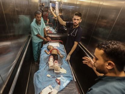 Palestinian doctors treat an injured child at Khan Younis hospital after an Israeli airstrike on Monday.