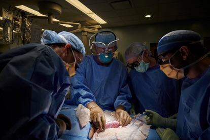 Surgeons at a New York hospital examine a patient for possible rejection of a pig kidney, in September 2021.