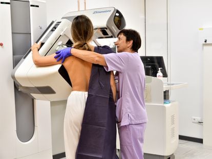 A mammogram being carried out at a hospital in the Basque Country.