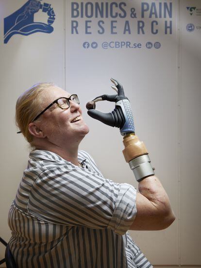 Karin, with her bionic hand connected directly to her neuromusculoskeletal system, at the Center for Bionics and Pain Research in Gothenburg, Sweden.