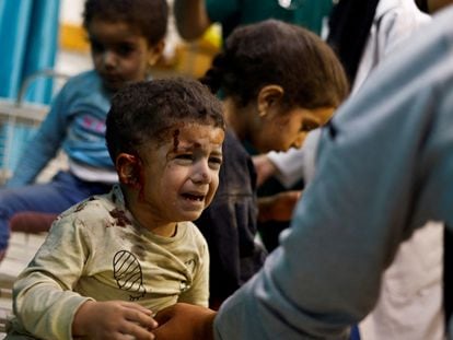 Palestinian children injured in an Israeli attack at the Nasser hospital in Gaza.