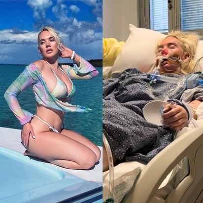 Left, Jennifer Barlow in the Bahamas, and right, in hospital after contracting the infection. Images shared on her social media accounts.