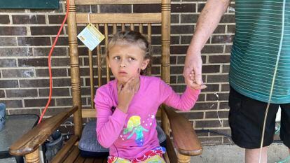 Kinsley White, 6, shows reporters a wound left on her face, Thursday, April 20, 2023 in Gastonia, N.C.