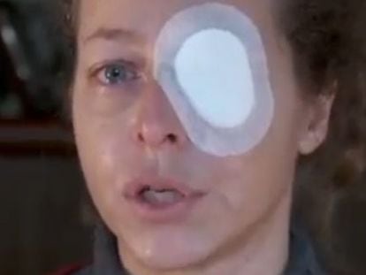 Ester Quintana lost an eye during a demonstration in Barcelona in support of the November 14 general strike.