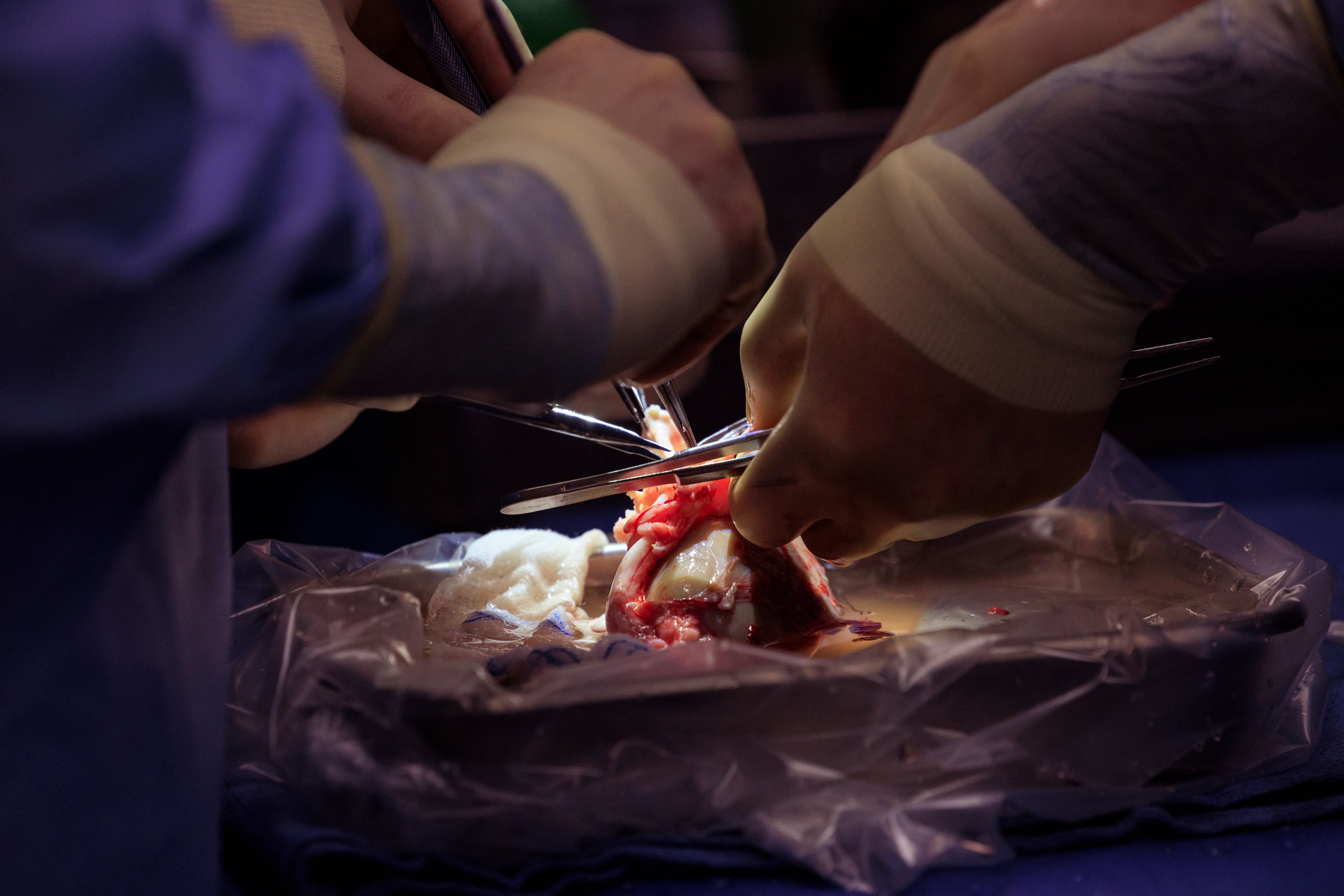 Science, pigs and money: the race between the US and China to make animal-to-human transplants viable