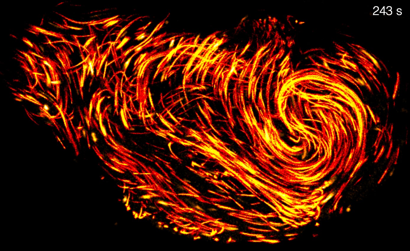 How thousands of sperm squeeze into a space 10 times smaller without getting tangled