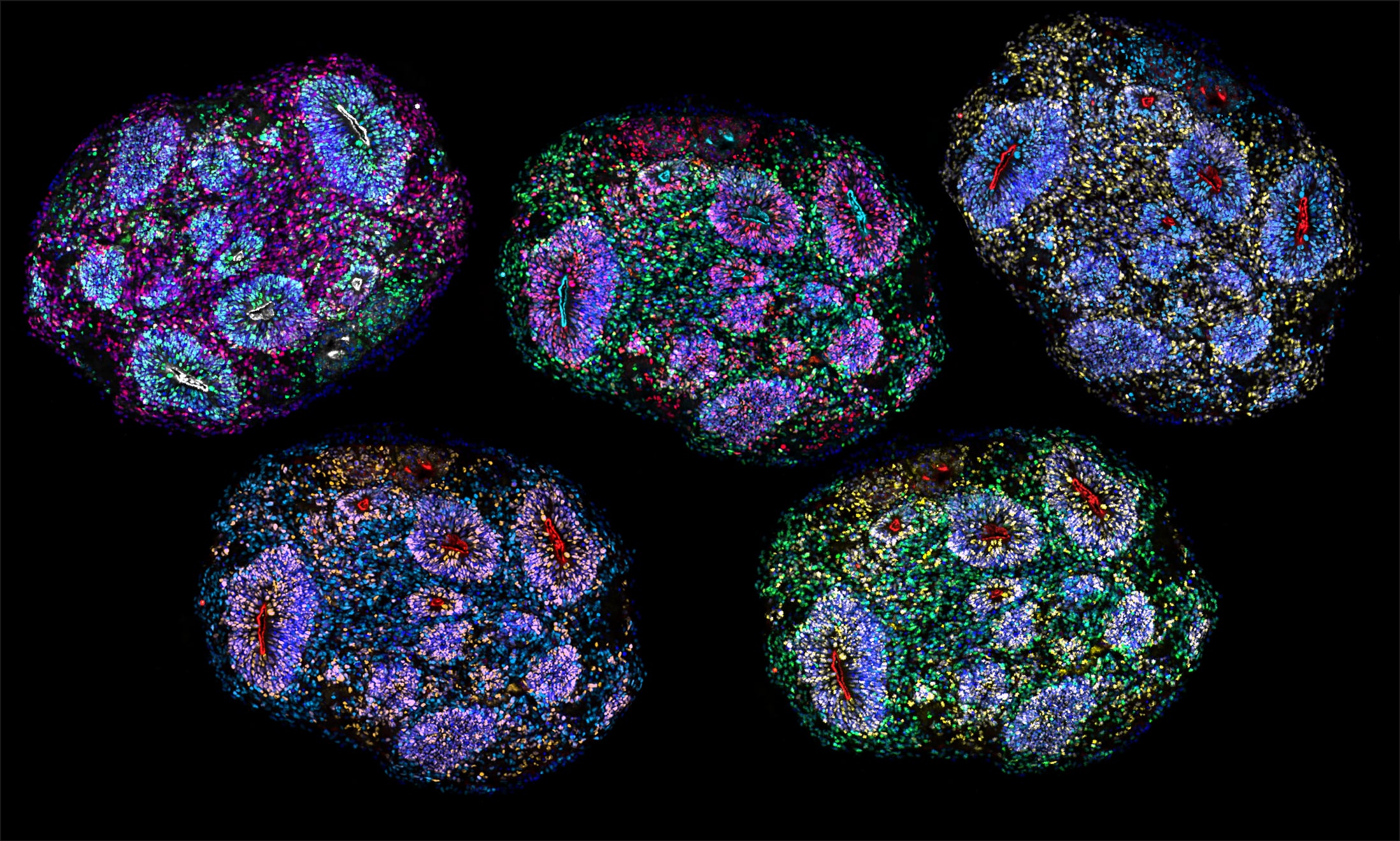 Breakthrough in neuromedicine as human mini-brains are kept alive for years