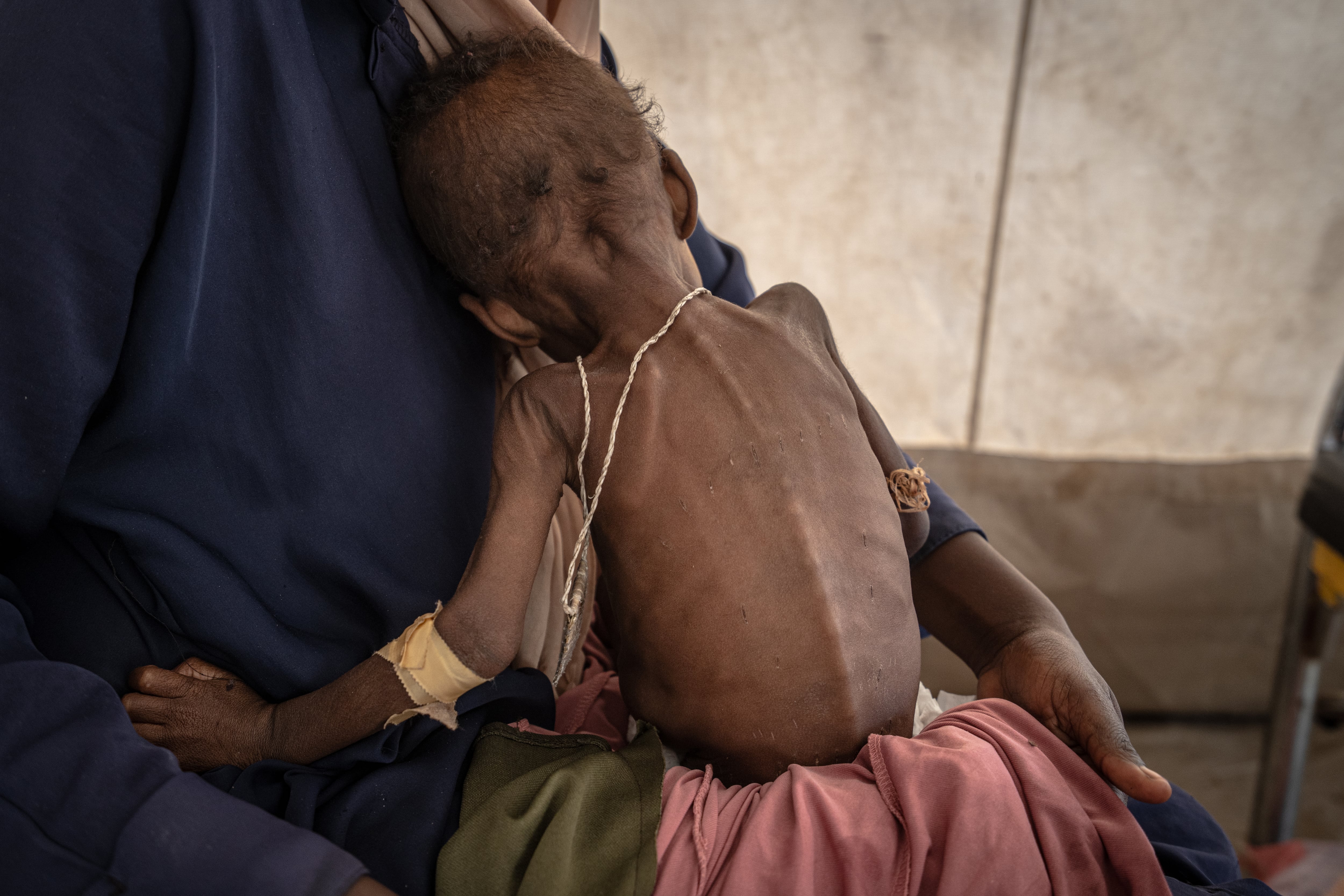 Africa becomes the global epicenter of hunger for the first time