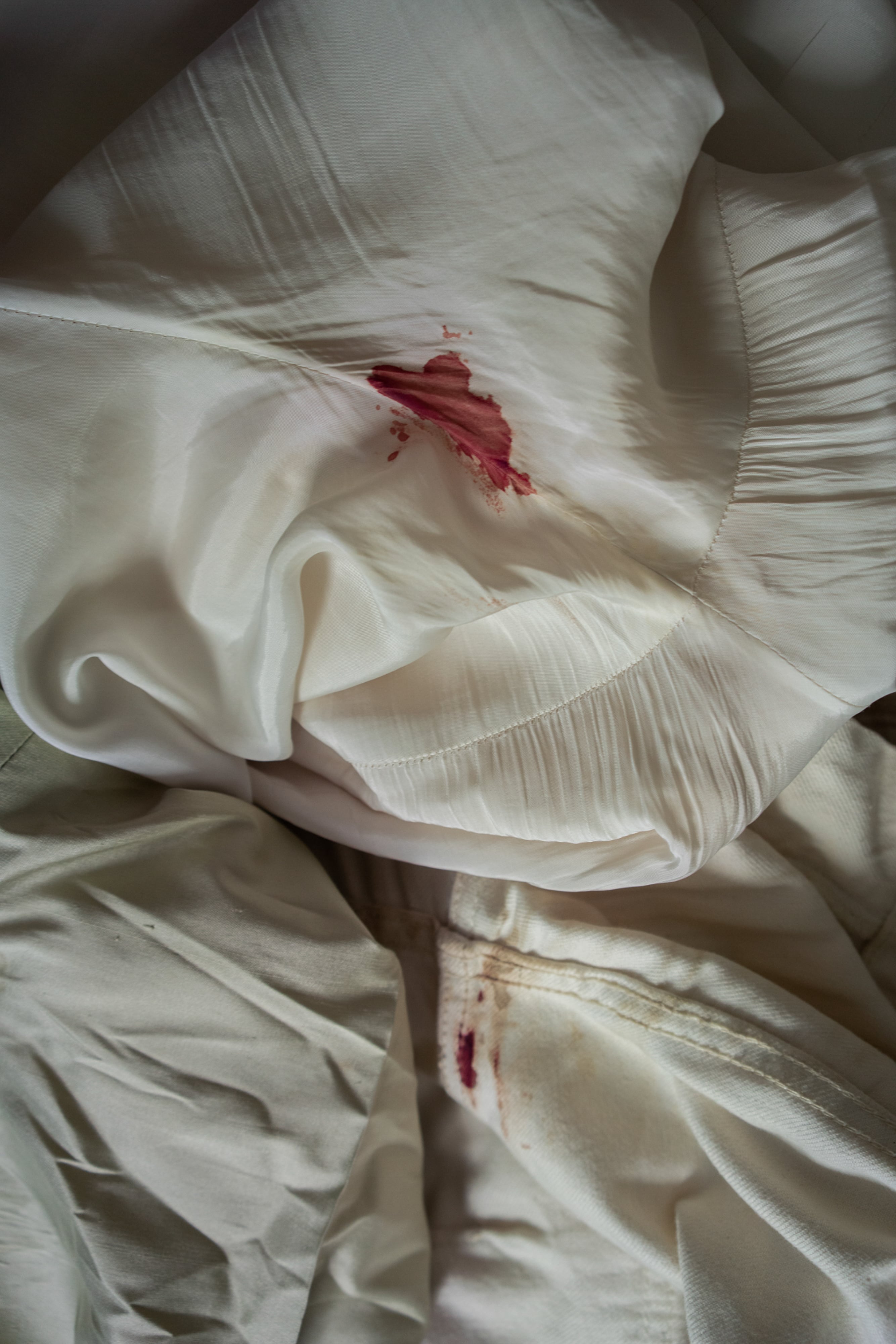  The owner of this pair of pants had an abortion two months before the photo was taken, but was still bleeding. Caracas, Venezuela, March 26, 2023.