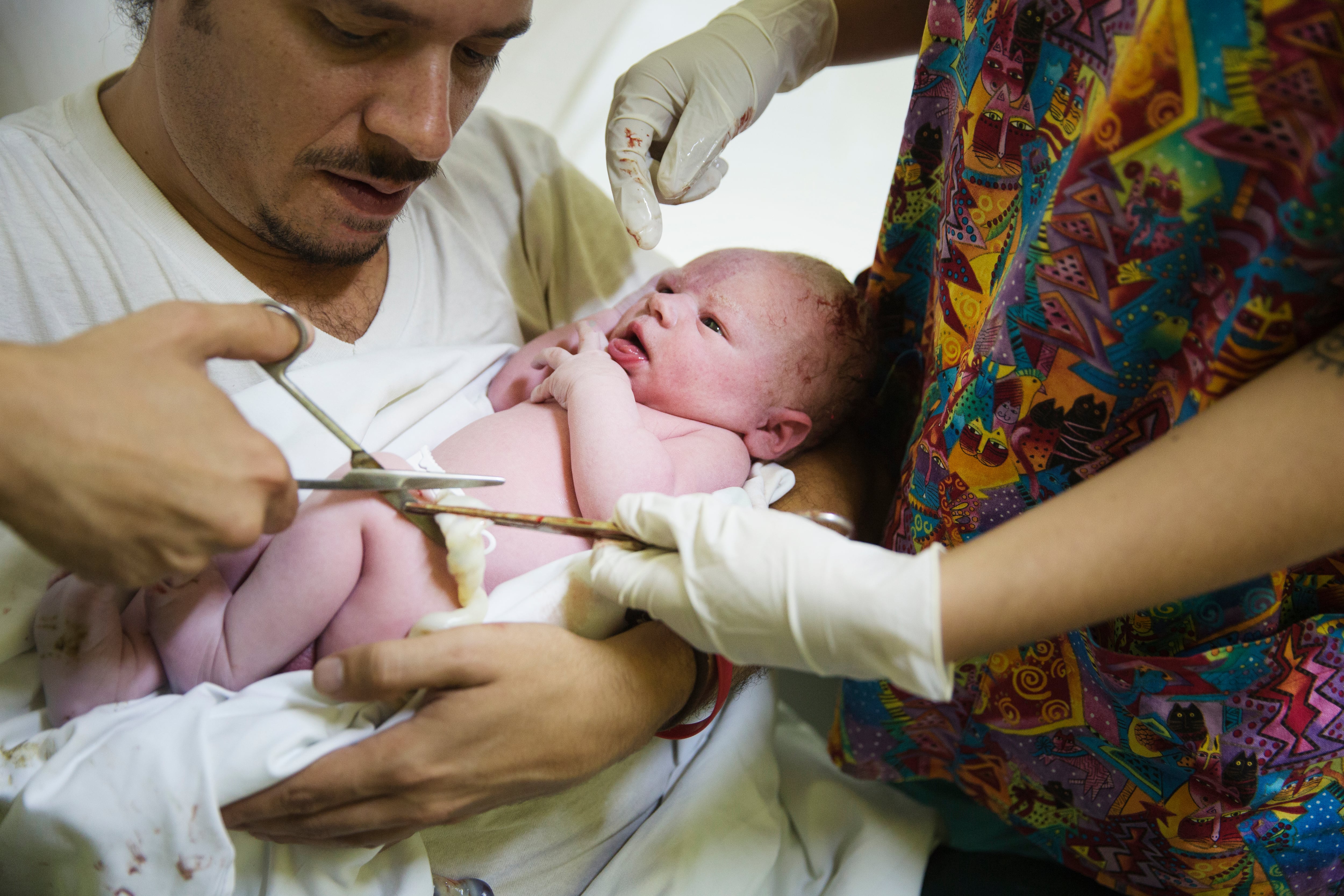 Parents’ umbilical cord dilemma: Donate or preserve, even if it may never be used