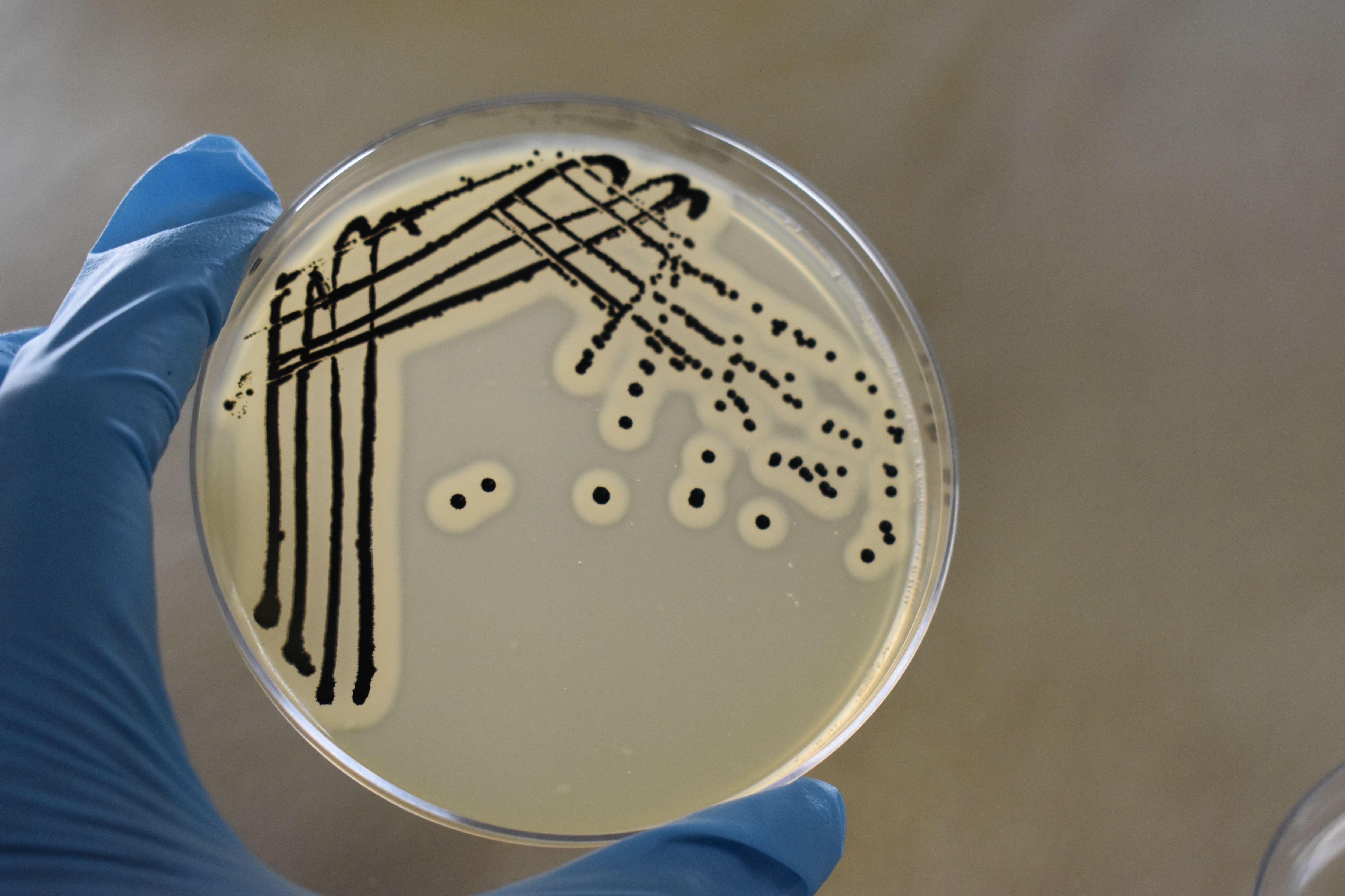 Superbacteria’s double defense against antibiotics is discovered