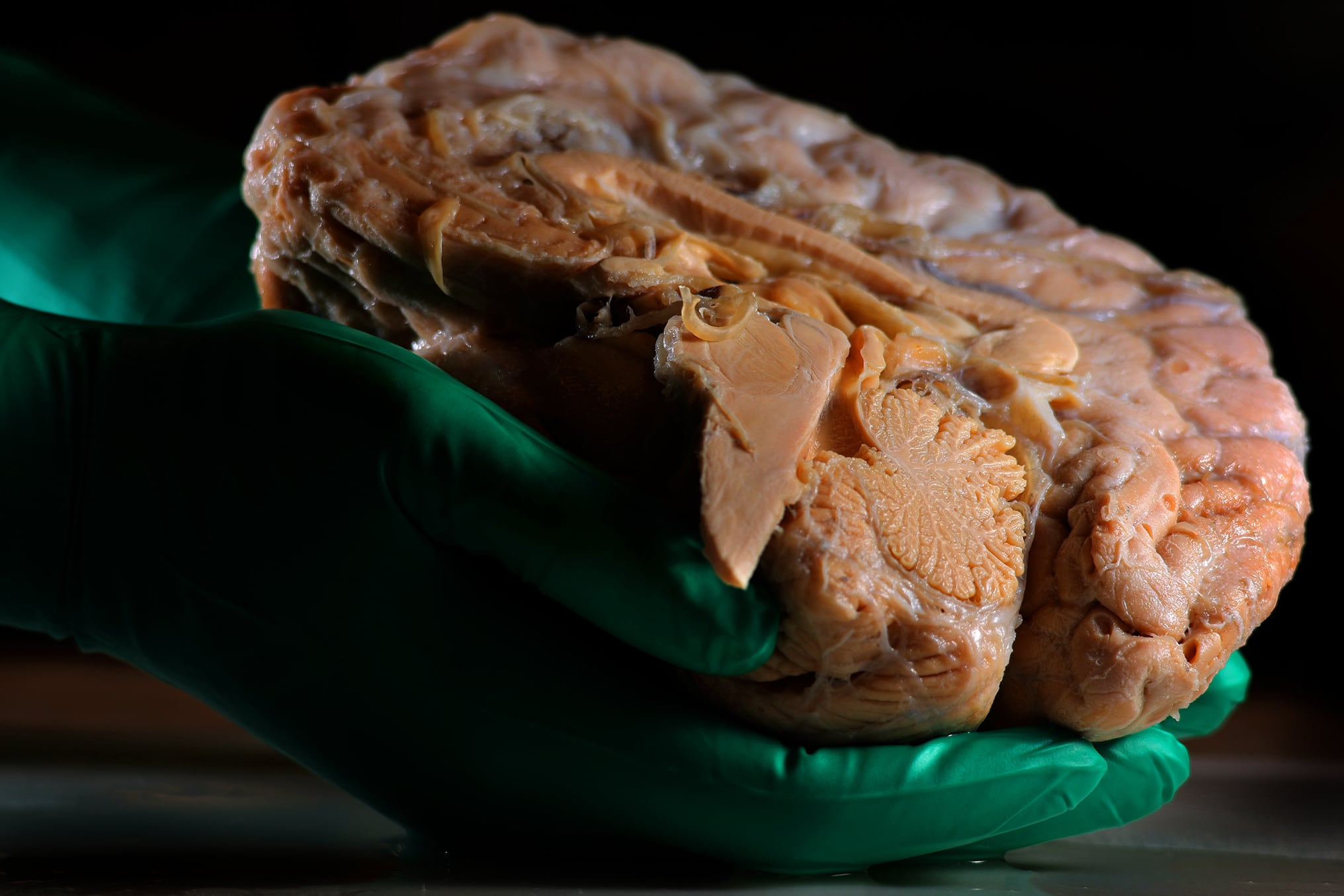 Do you leave everything for later? Japanese scientists have found the reason in the brain