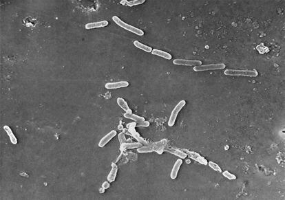 This scanning electron microscope image made available by the Centers for Disease Control and Prevention shows rod-shaped Pseudomonas aeruginosa bacteria.