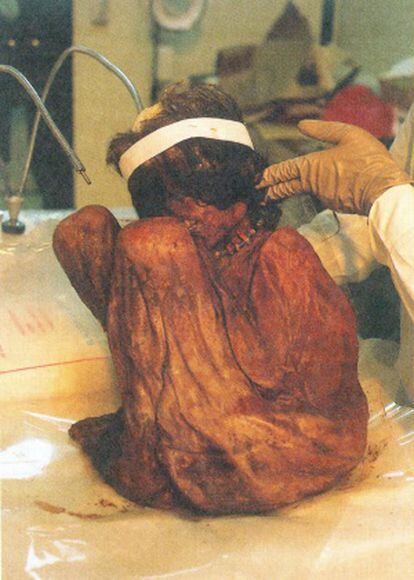 The Aconcagua mummy.