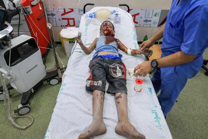Health workers at Khan Younis hospital treat a Palestinian child injured after an Israeli attack, on October 16.