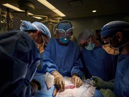 Surgeons at a New York hospital examine a patient for possible rejection of a pig kidney, in September 2021.
