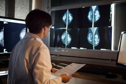 A radiologist monitors the results of a mammogram.