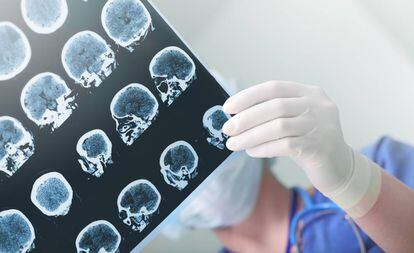 A doctor studies a patient's brain damage.